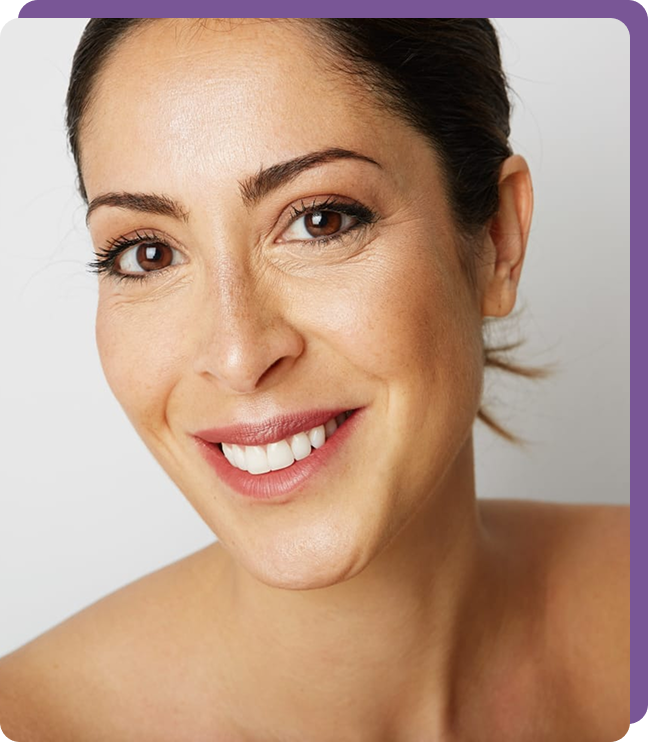 Dermal Filler Treatment